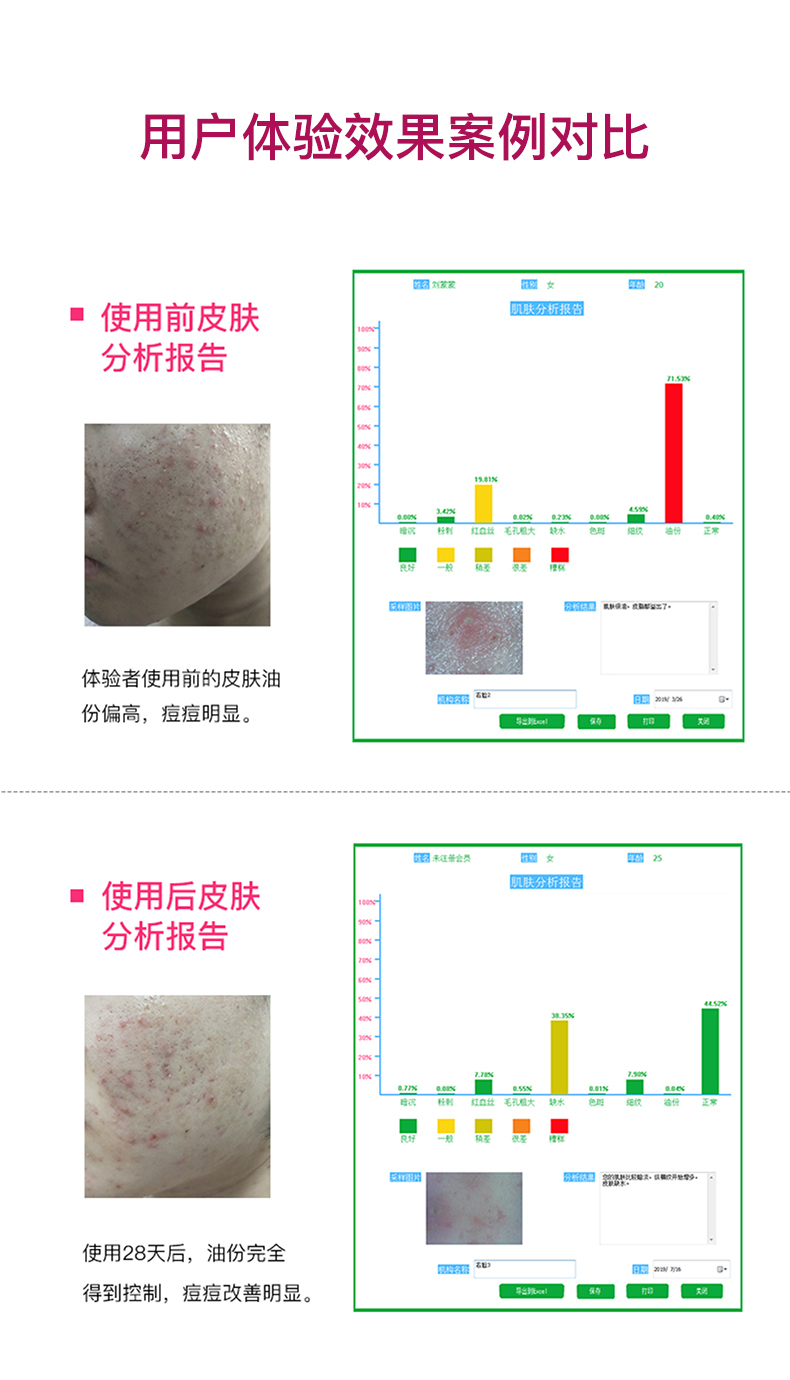 矿物质美肤仪_09.jpg